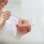 Dental Implant Techniques